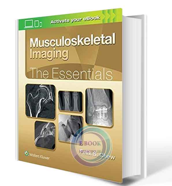 دانلود کتاب Musculoskeletal Imaging: The Essentials (Essentials Series) First 2018 (ORIGINAL PDF)